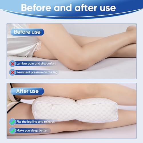 Cooling Knee Pillow for Side Sleepers - High Support leg Positioner